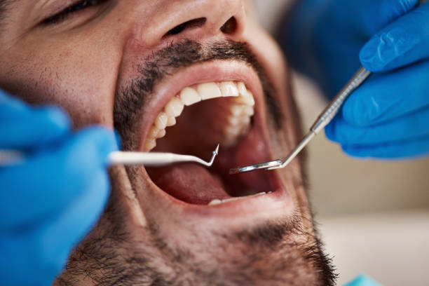 Best Broken or Cracked Tooth Emergency Dentist in Elkins, WV