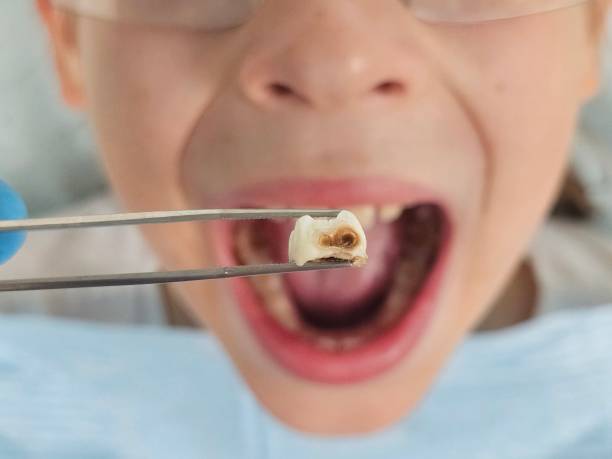 Best Pediatric Emergency Dentist in Elkins, WV
