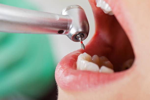Best Weekend Emergency Dentist in Elkins, WV